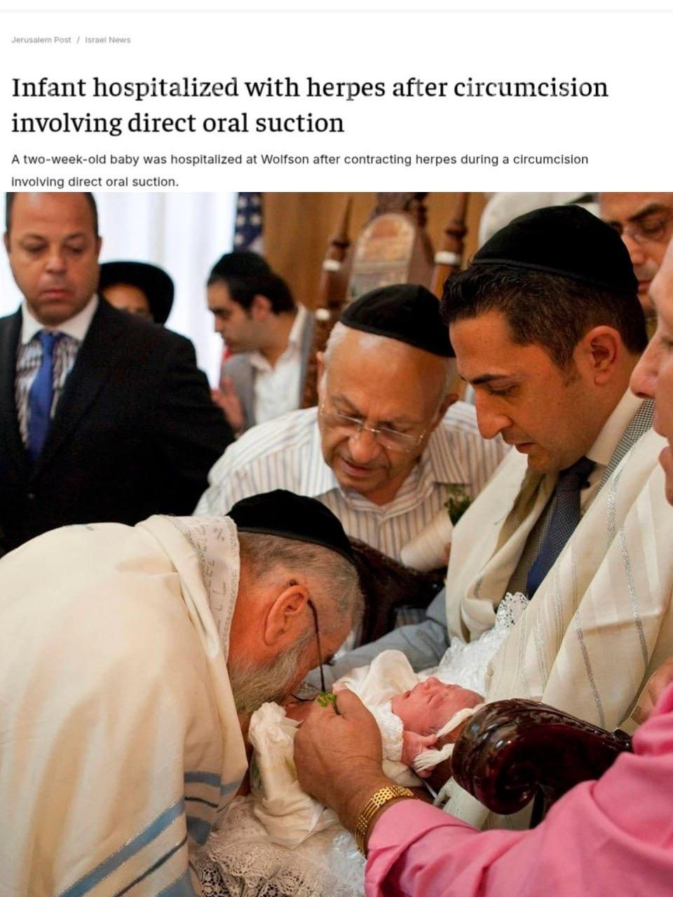 一名以色列犹太教拉比为新生儿举行割礼仪式导致新生儿住进ICU以色列一名