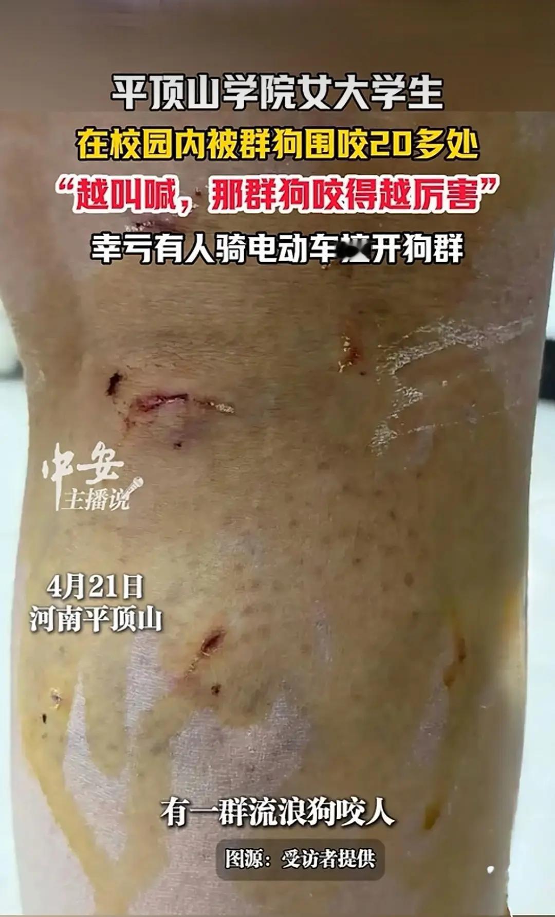 大学为何会有如此多的流浪狗？十几只狗围攻一名女生，咬完后保安才去抓捕。在狗咬