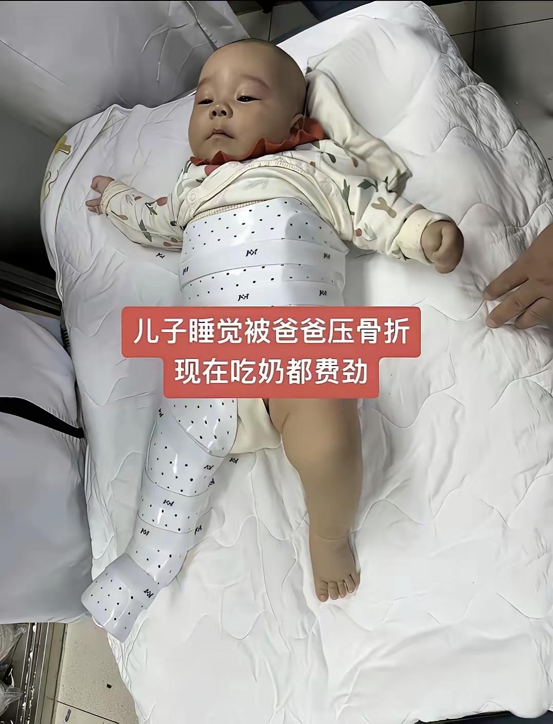 年龄最小的腿骨折！​看到这娃裹着固定带的样子，真的心疼得慌！才几个月大的宝宝