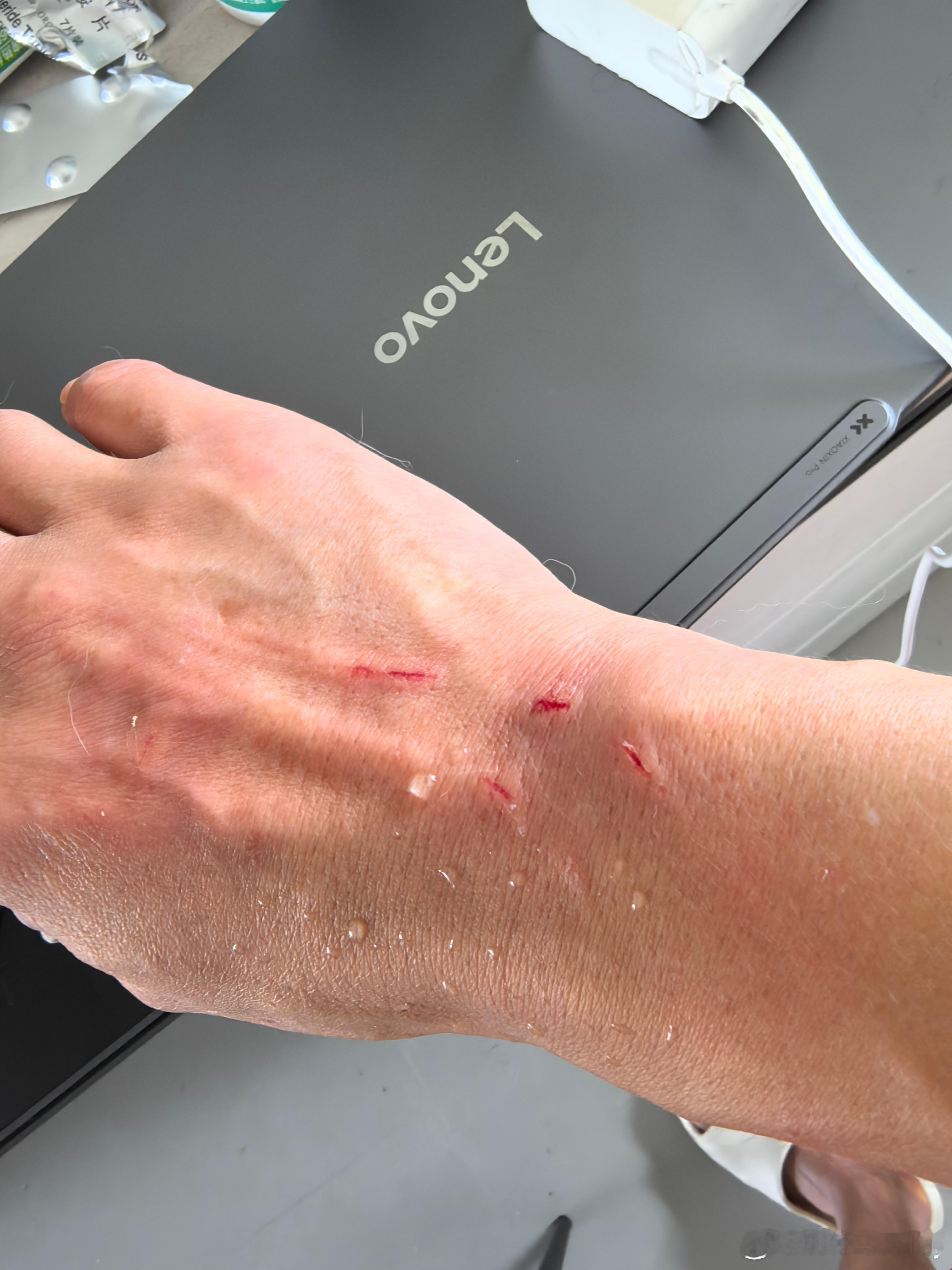 受伤了，家里的逆子，要去打狂犬疫苗。进入发情期了，平时都在宠物店洗澡，这次说在家