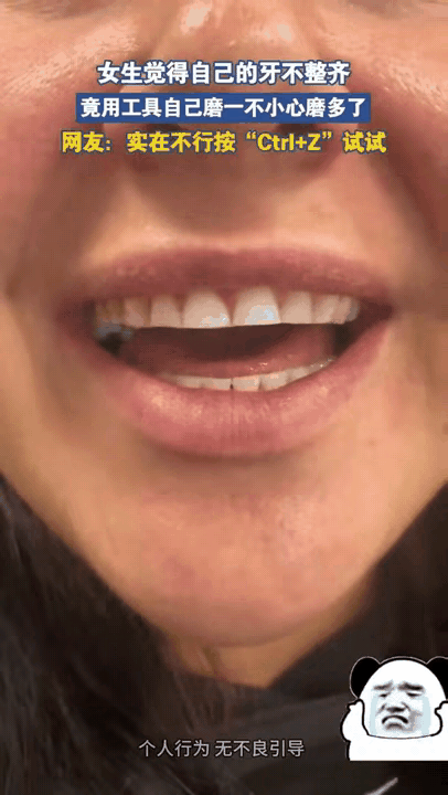 真是人才！男子嫌牙不齐，自己动手磨，结果磨到咬不了东西男子觉得自己牙齿不整
