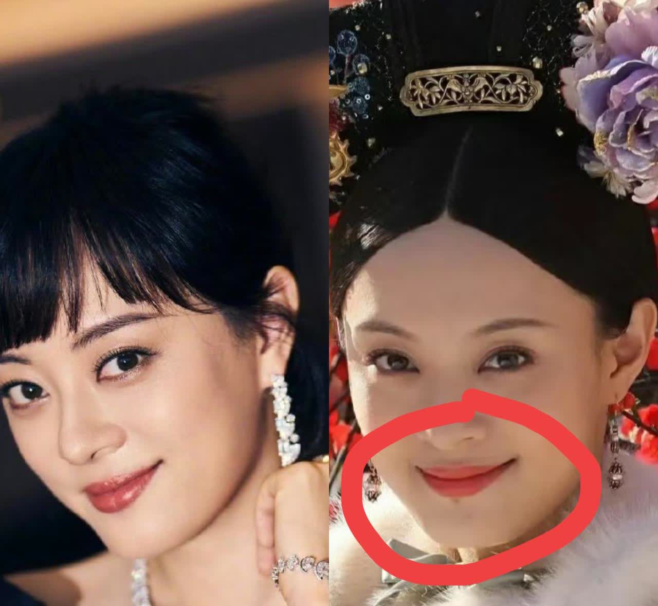 孙俪肯定被高人指点了，这颗痣太影响她的运势了，终于点掉了。