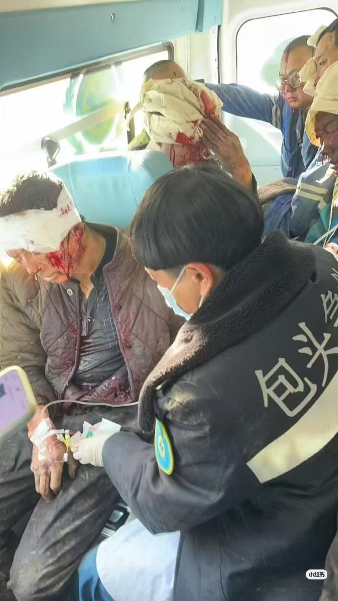 包头一钢厂爆炸致多人伤亡，医院已收治40余人。包头钢厂爆炸今日（1月18日）1