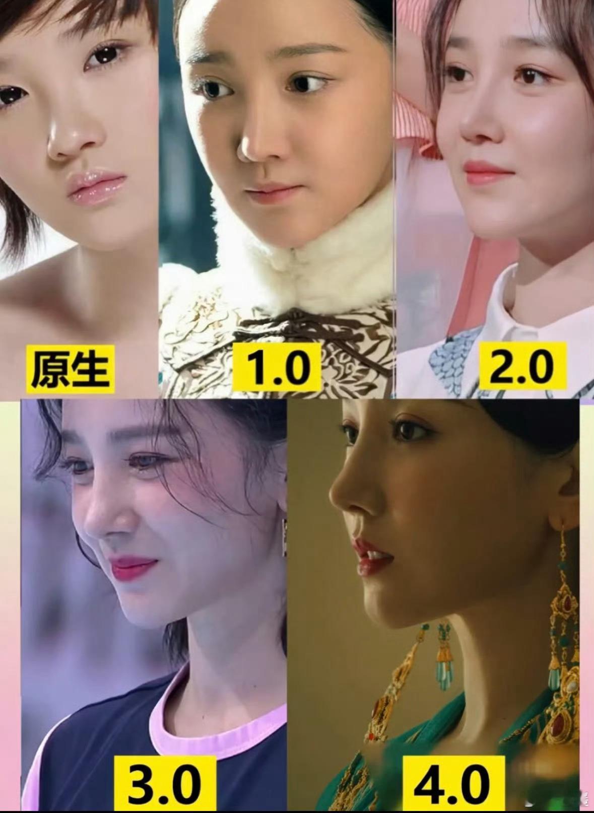 陈小纭整骨整容也是有保质期的修修补补，最后得不偿失​​​