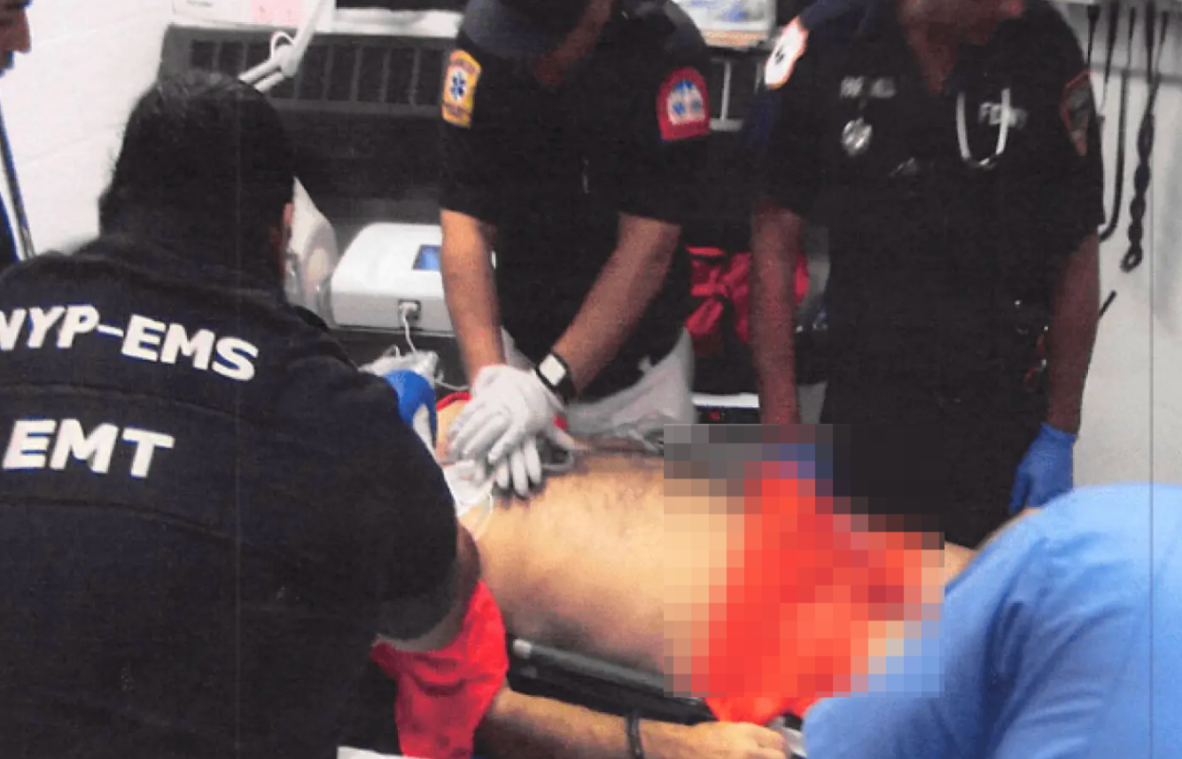 爱泼斯坦自缢真相首度曝光：血色勒痕与断裂甲状软骨惊人细节