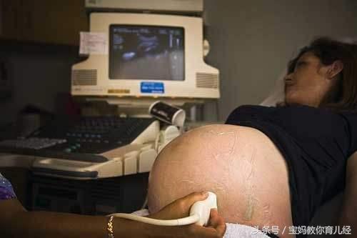 高龄产妇孕38周检查胎死腹中!