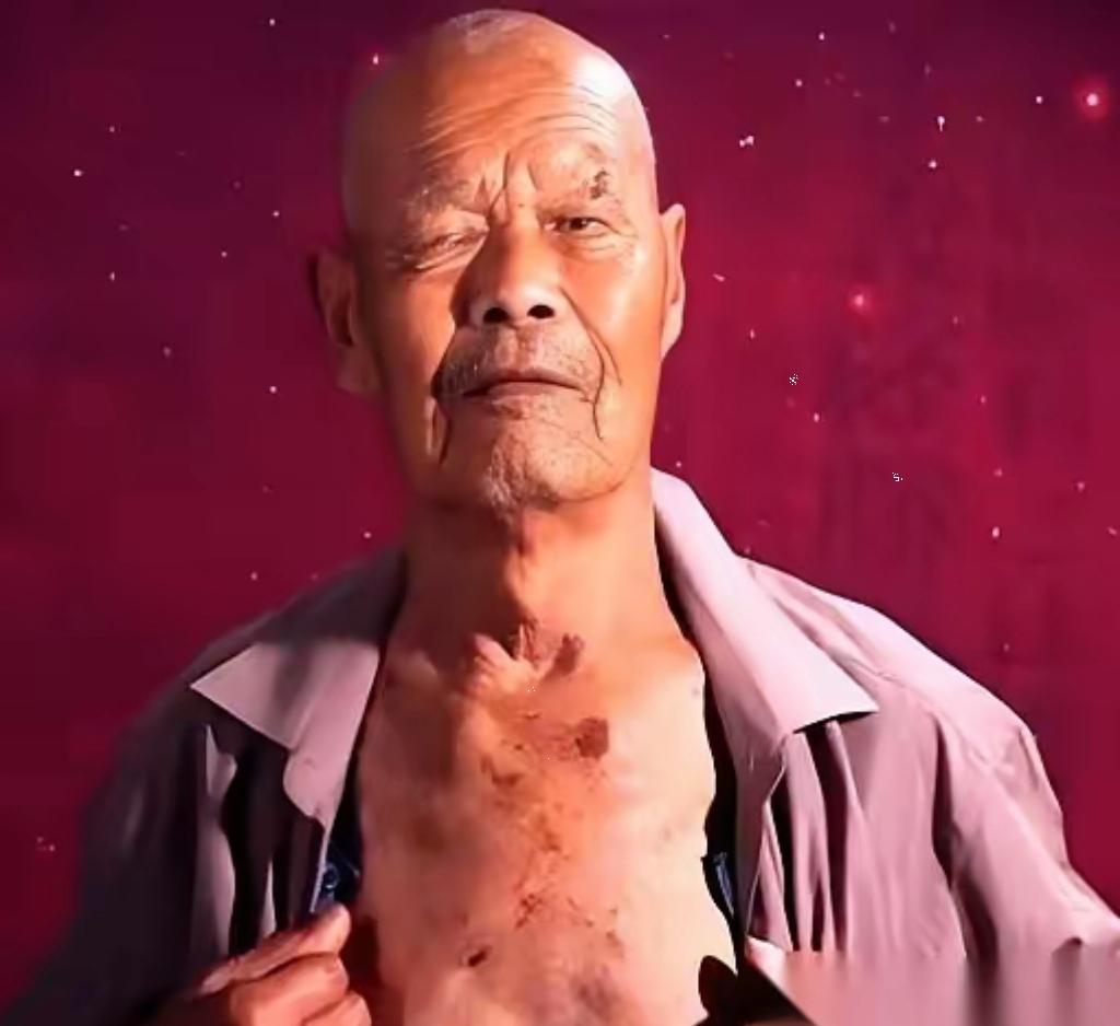 一个山东大哥，咳嗽了十年。某天在地里干活，咳得惊天动地，突然“哇”一声，从嘴里