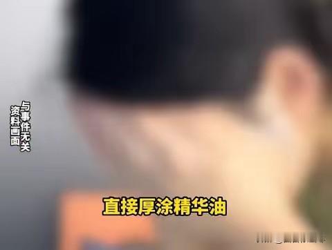 “悲剧还是发生了！”近日，福建福州，一女子感觉近期皮肤干燥，使用水乳后也没有好转