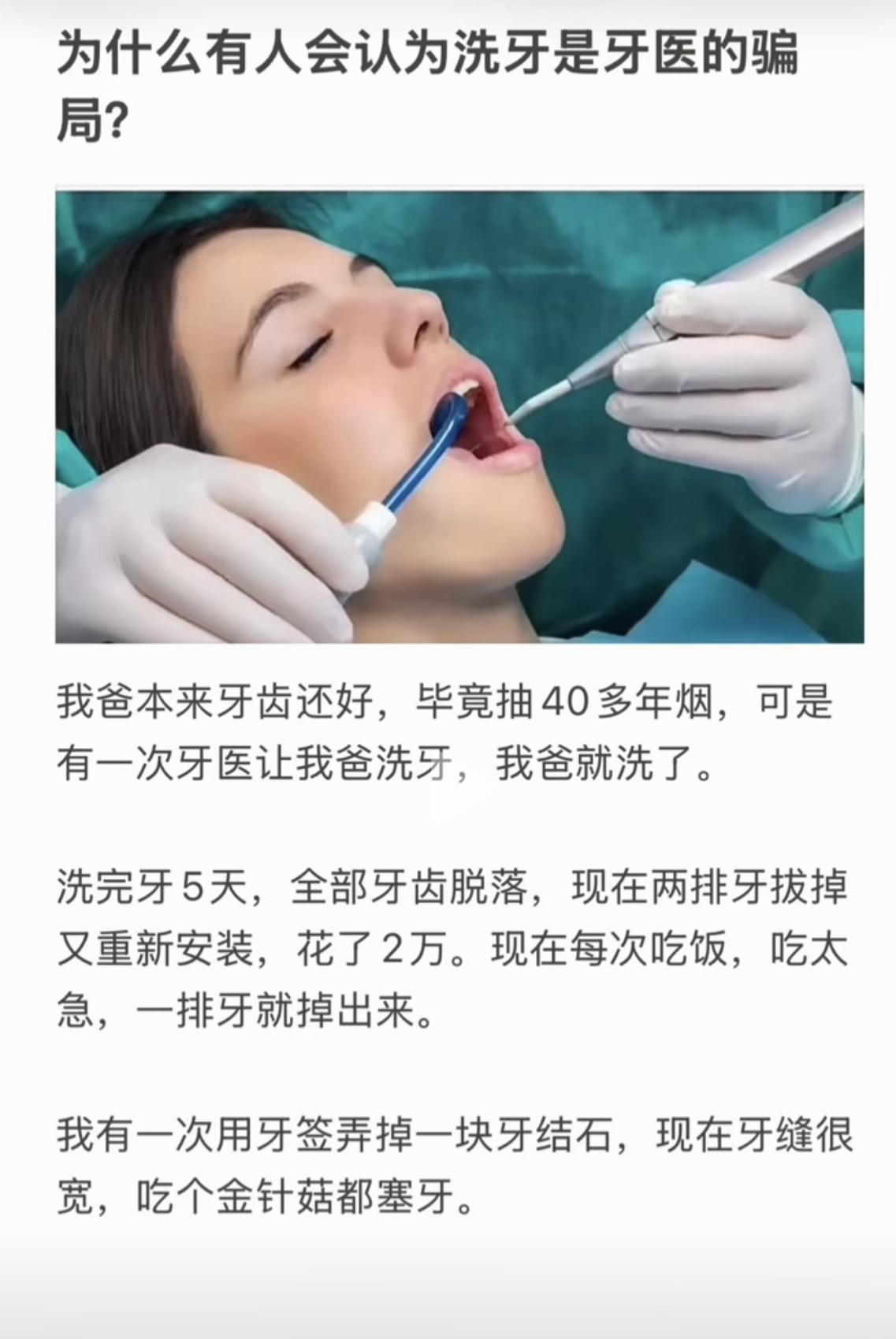 到底该不该洗牙？