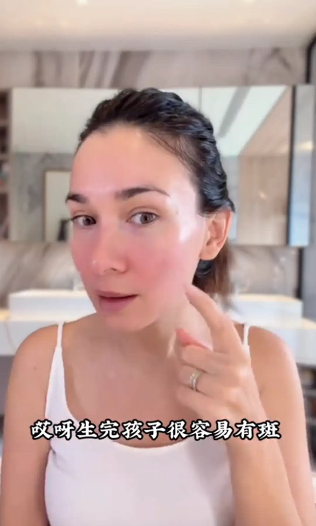 卢靖姗二胎后晒素颜，脸上长斑却被全网夸：这才是妈妈最真实样子！