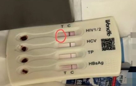 北京桔子水晶酒店惊魂：洗漱包藏用过HIV检测盒，男子连夜就医！官方介入调查“