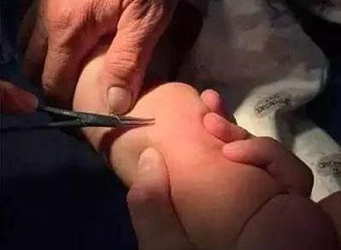 男婴身上被扎百根刺, 衣服惹的祸, 父母注意这种别再给孩子穿