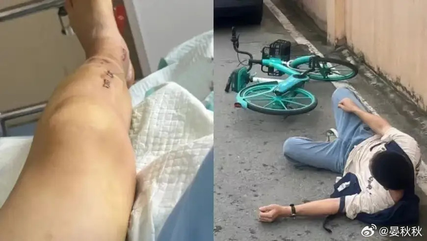 夺命锁共享单车骑着骑着，轮子突然自己锁死，把人狠狠摔出去——这种听起来像“意外”