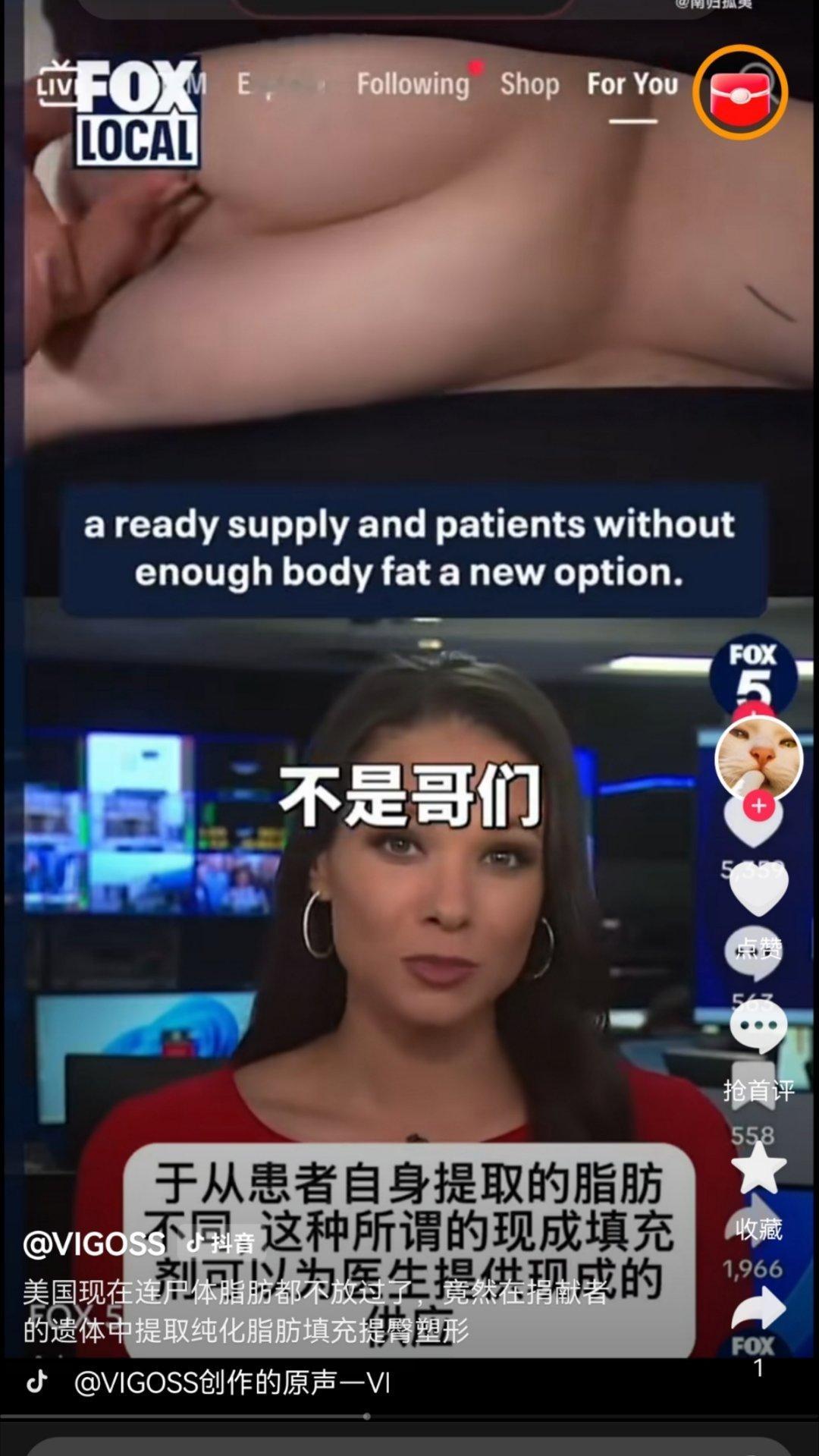 美国现在连尸体脂肪都不放过刷新三观！居然是从捐赠的尸体里提取的脂肪，经过处理后做