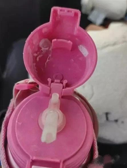 这才一年级啊，幸亏提前发现了