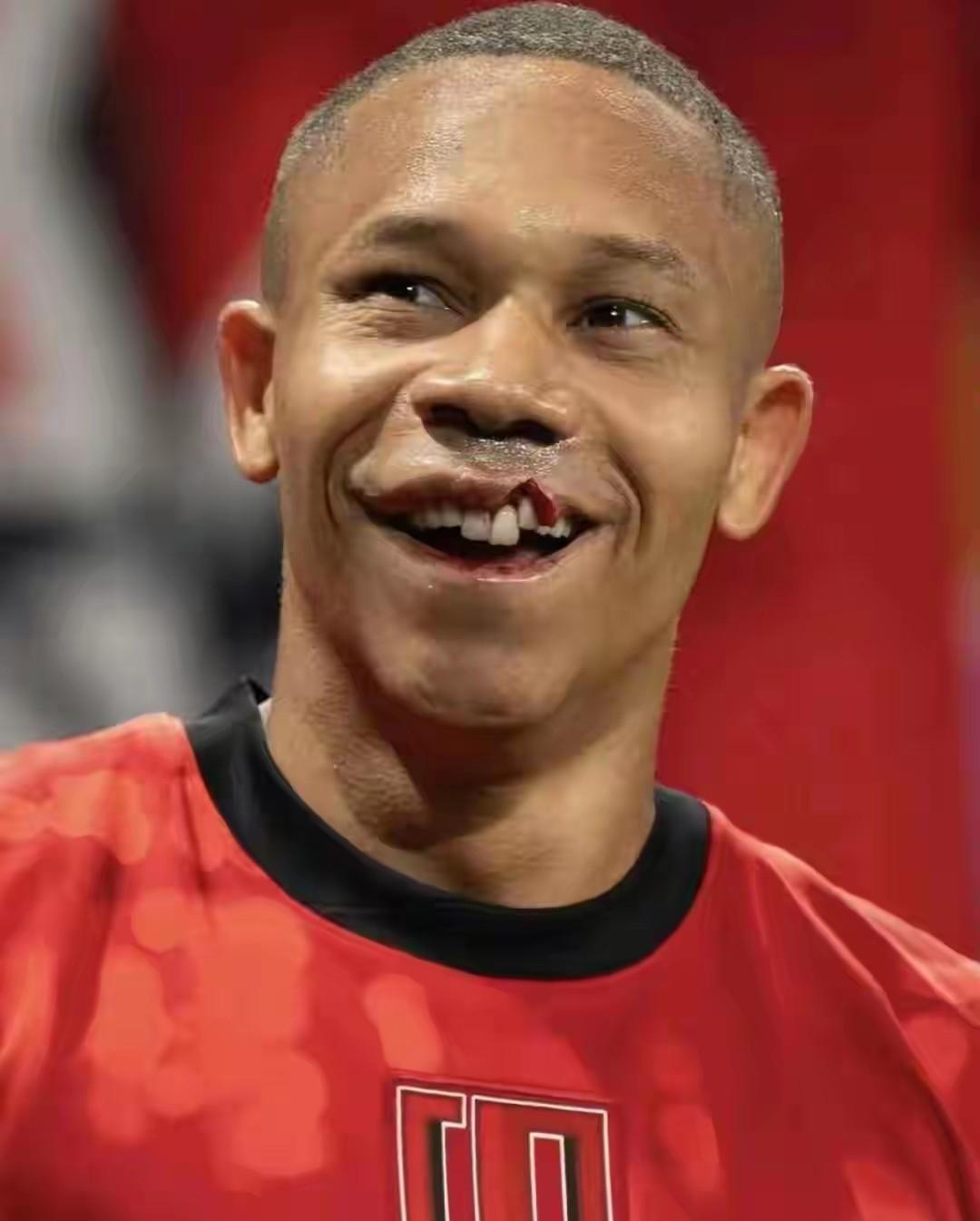 果然，姜至鹏的红牌引发争议，连“直播吧”也来站队，说老姜挥手非故意、力量不重、姜