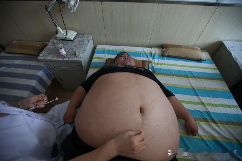 女子半年减肥50斤后确诊尿毒症晚期2026开年，浙江28岁的小张为拍婚纱照疯狂