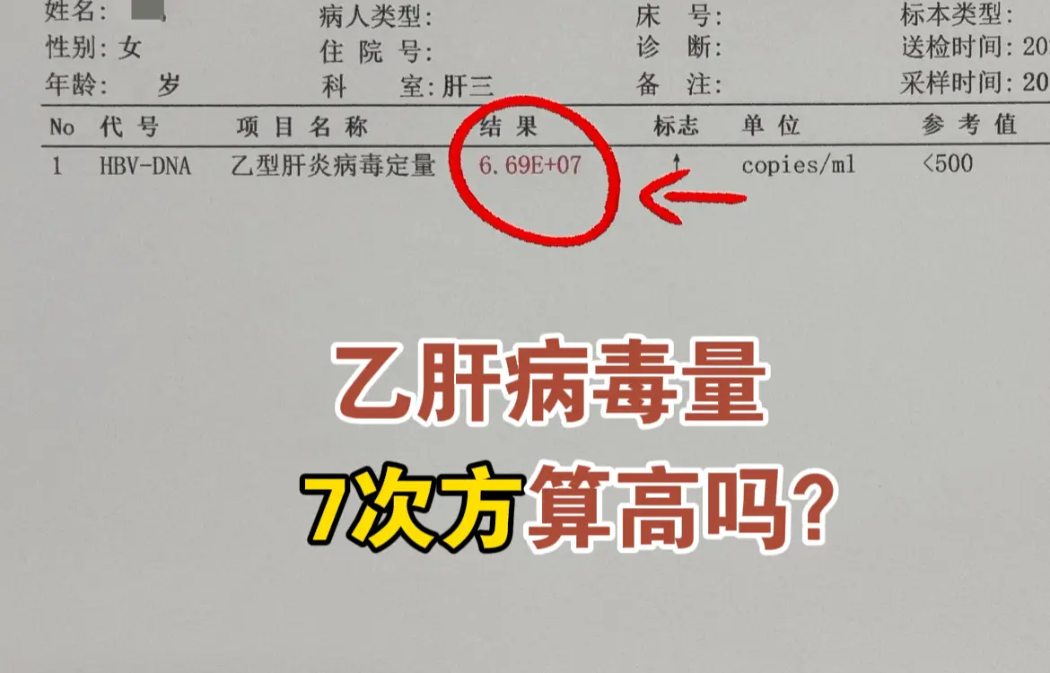 乙肝病毒量7次方算高吗？。先来看一下这张化验单，6.69E+07=66...