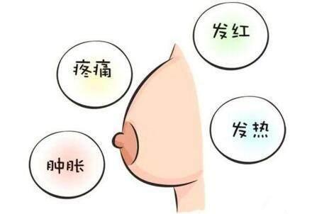 产后涨奶很苦, 6个方法缓解新妈咪产后涨奶痛!