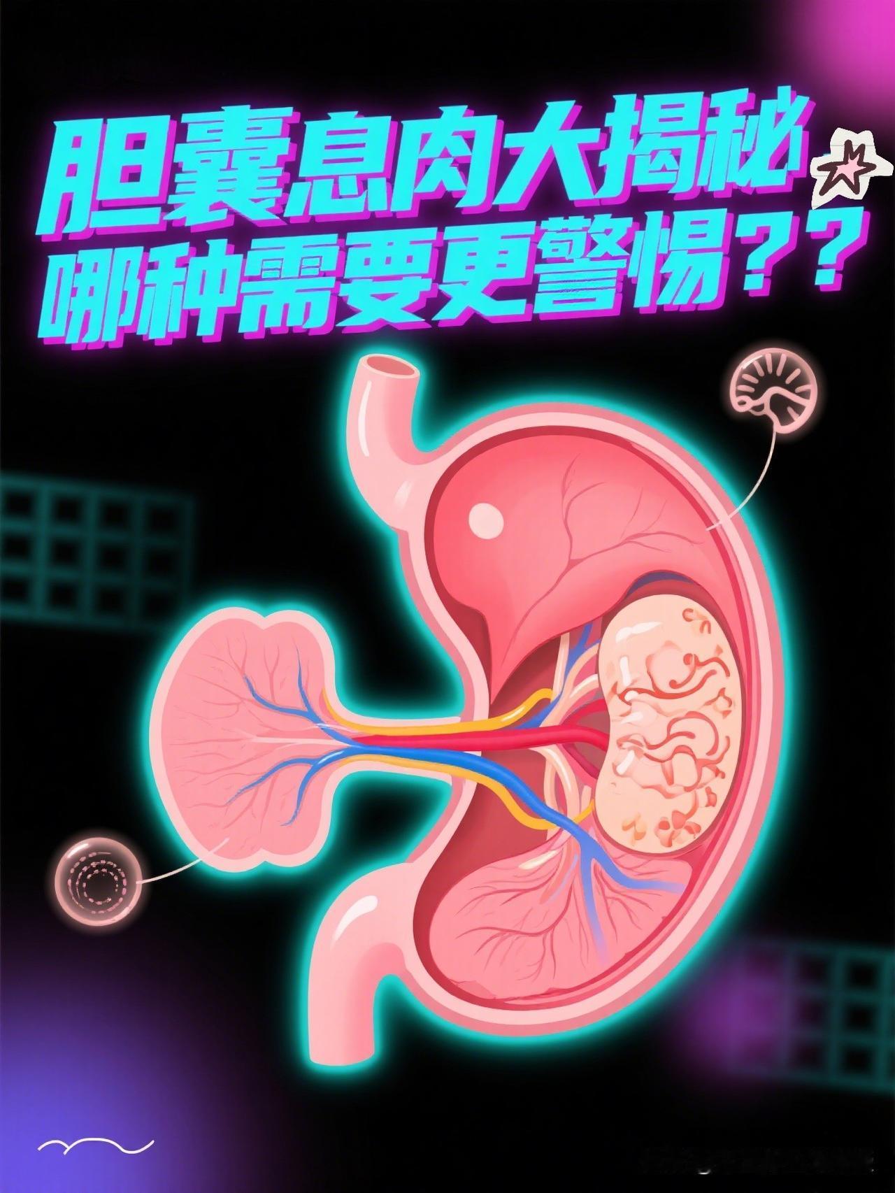 胆囊息肉大揭秘，哪种需要更警惕？？？–随着腹部超声检查的普及，越来越多的人在
