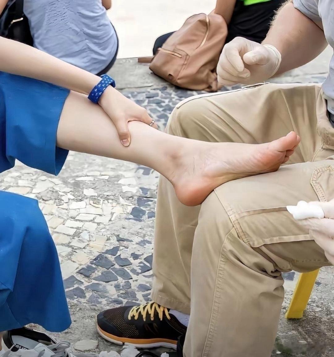 宋祖儿这是出国玩把脚弄伤了？这把脚搭在异性腿上合适吗？