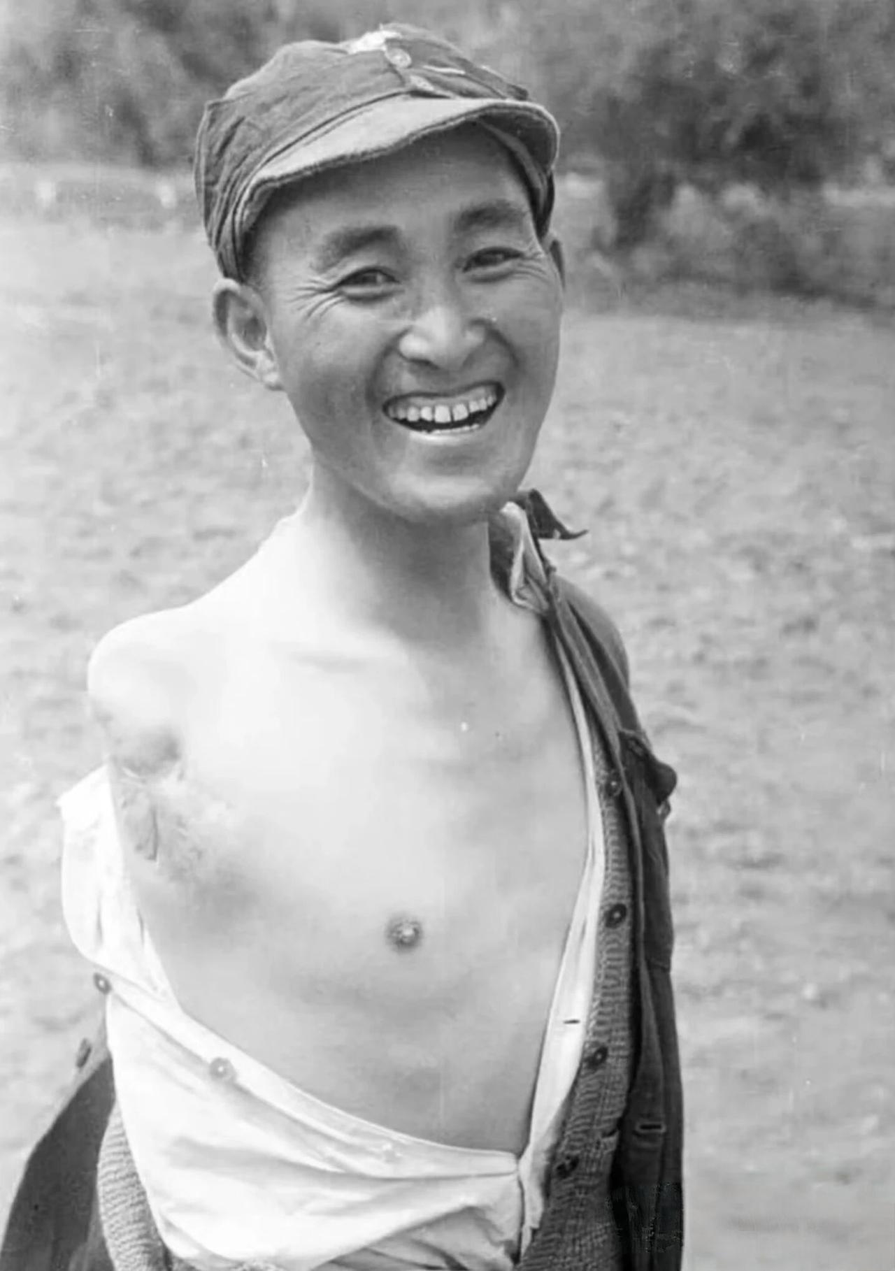 图一是开国少将左齐，1939年在一次战斗中，被日本鬼子打中右臂。当白求恩大夫见到