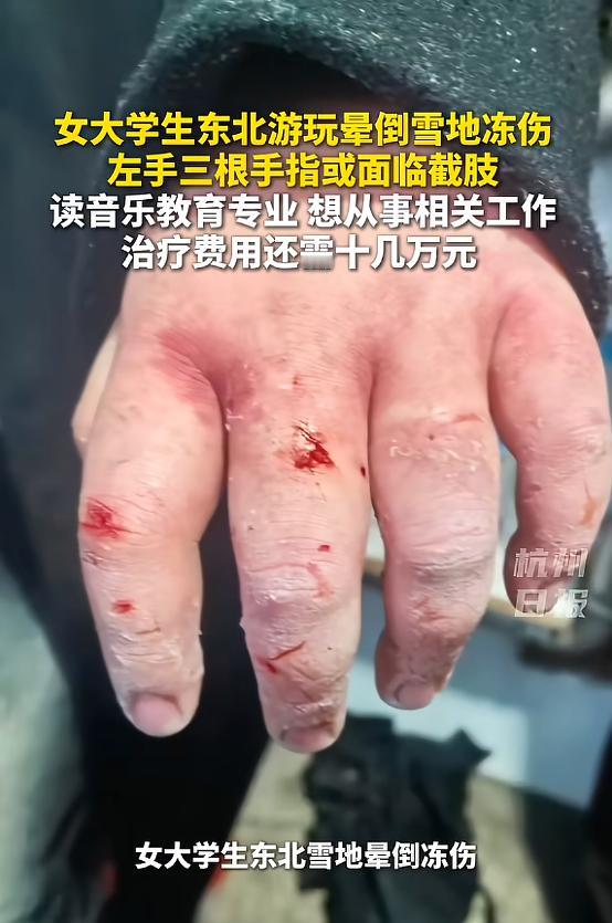 “悲剧还是发生了！”1月27日，黑龙江，一外地女生来旅游时，不慎意外摔倒，弄丢了