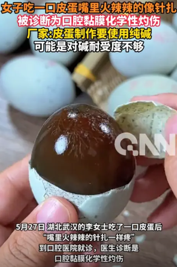 “防不胜防！”近日，湖北武汉，一女子在网上购买了皮蛋之后，在家里吃了一口，却突然