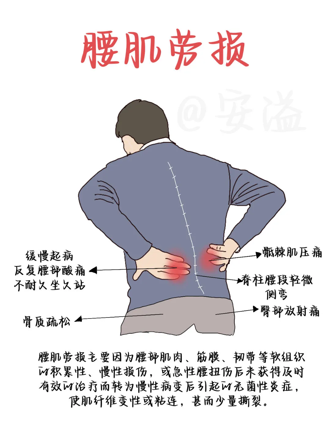 🔥腰肌劳损不是小事！打工人自救指南来