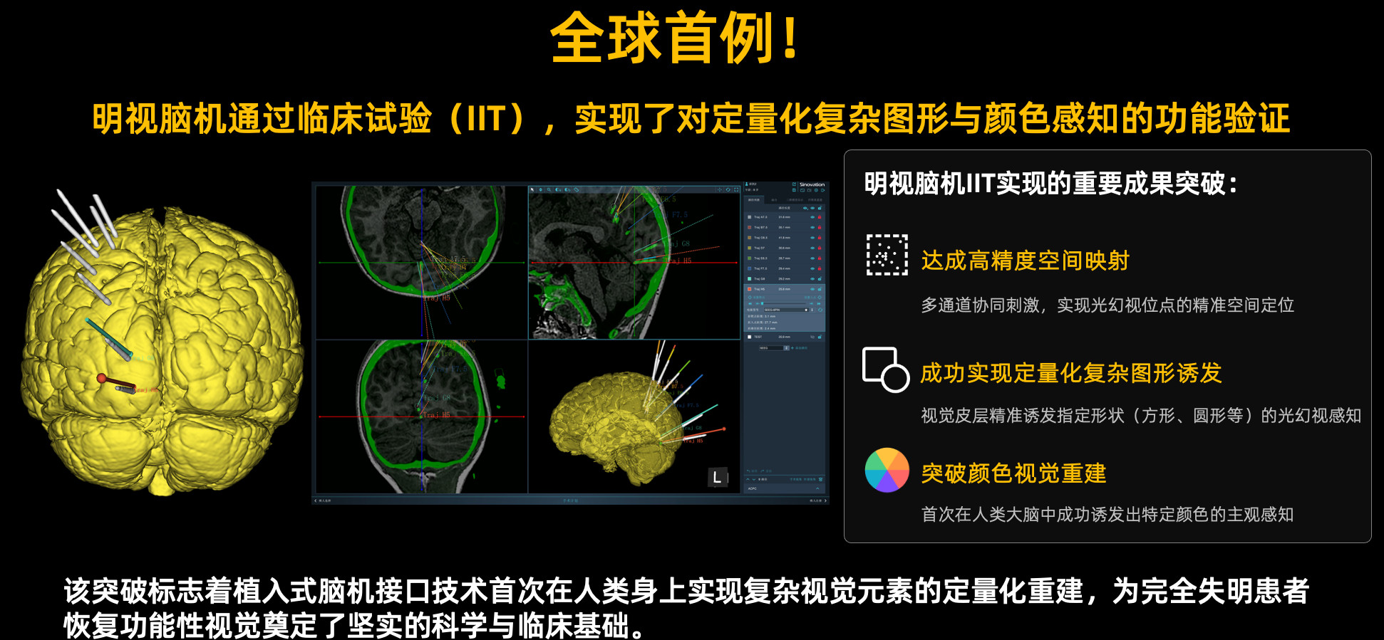 明视脑机获1.5亿融资，加速通过脑机接口助盲人复明4月2日，动脉网报道称，视觉重
