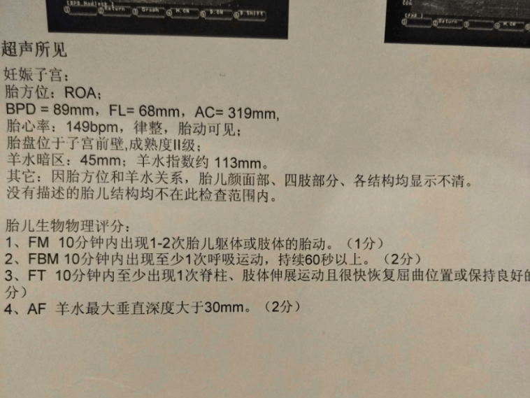 一直在网上接男宝, 二胎终于接到小宝贝了, 传好孕, 来接男宝啦