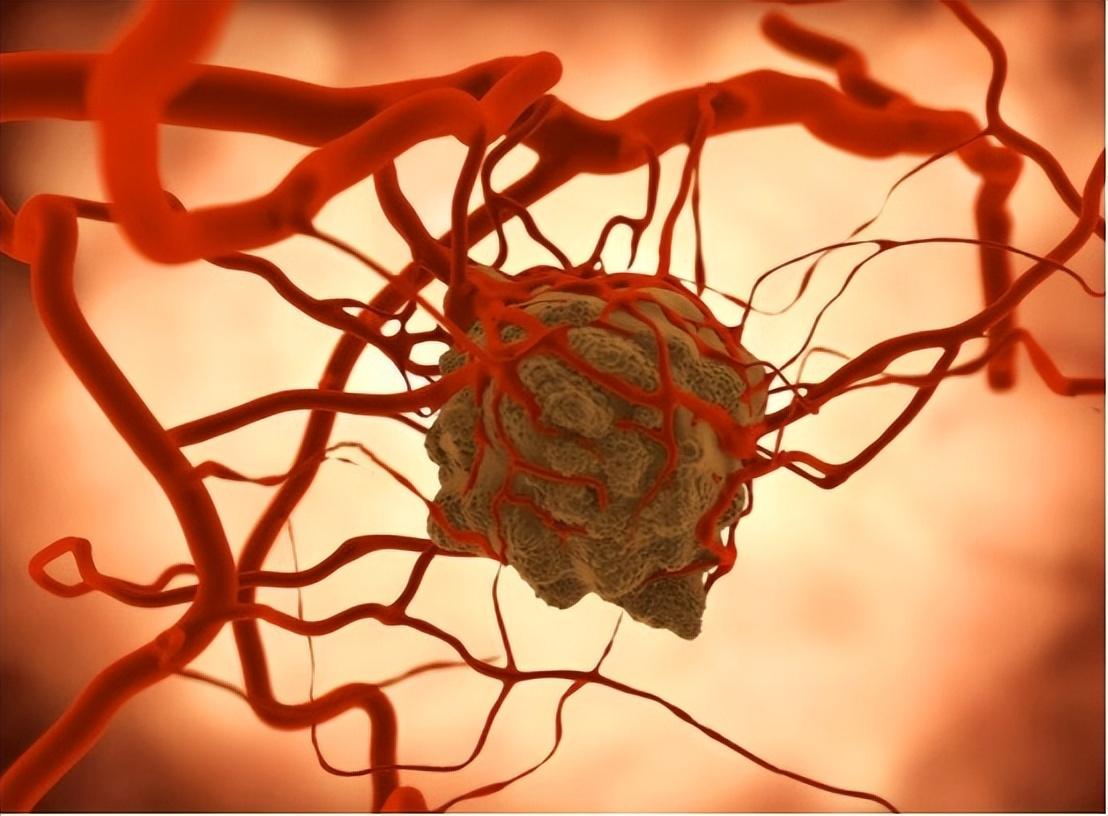 中国一年有457万人确诊癌症！提醒：这4种食物，再爱吃都要管住嘴人到中年，总