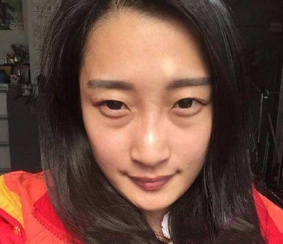 只有手术才能解决眼袋? 每天用“它”按摩, 淡化眼袋紧致肌肤