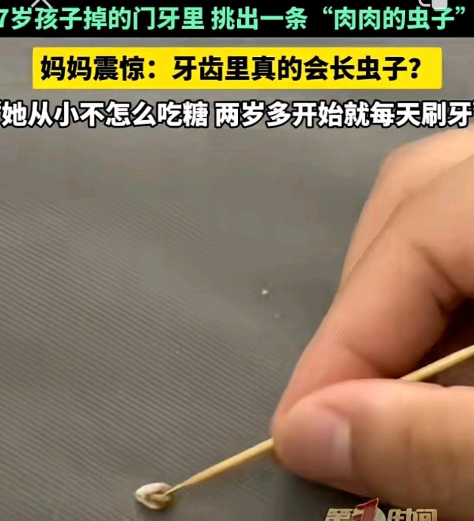 这是什么？河南商丘，一个七岁孩子在玩耍时碰掉了一颗坏门牙。妈妈拿牙签去翻那个牙洞