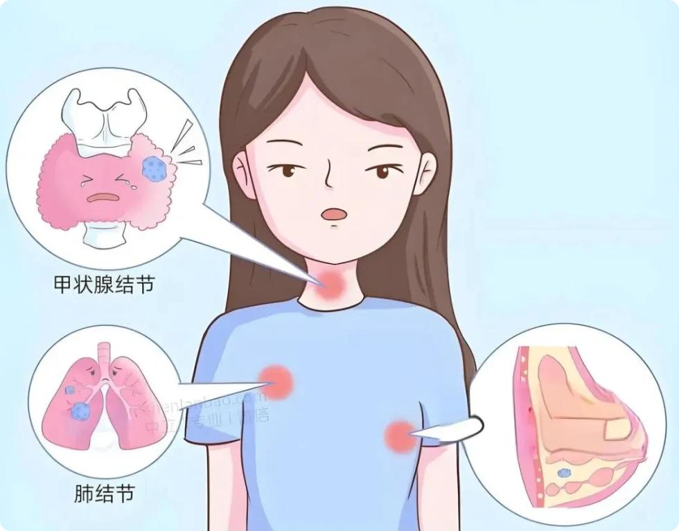 中医大实话：90%的慢性病、结节、增生，全是「堵」出来的！大家好，我是陈大夫