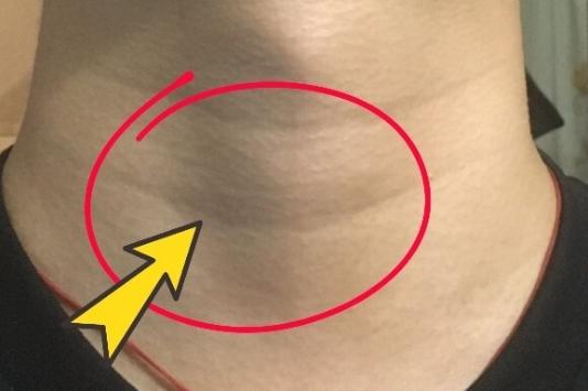 甲状腺有问题别怕！三句话教你科学应对查出甲状腺问题就慌神？稳住！记住这三句话，