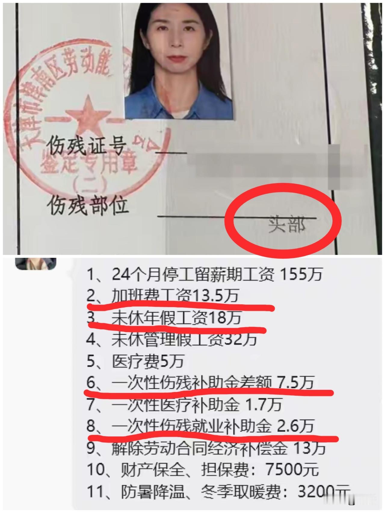 崔丽丽提出的工伤诉求这几个细节大家注意到没有？第一，崔丽丽的伤残部位是头