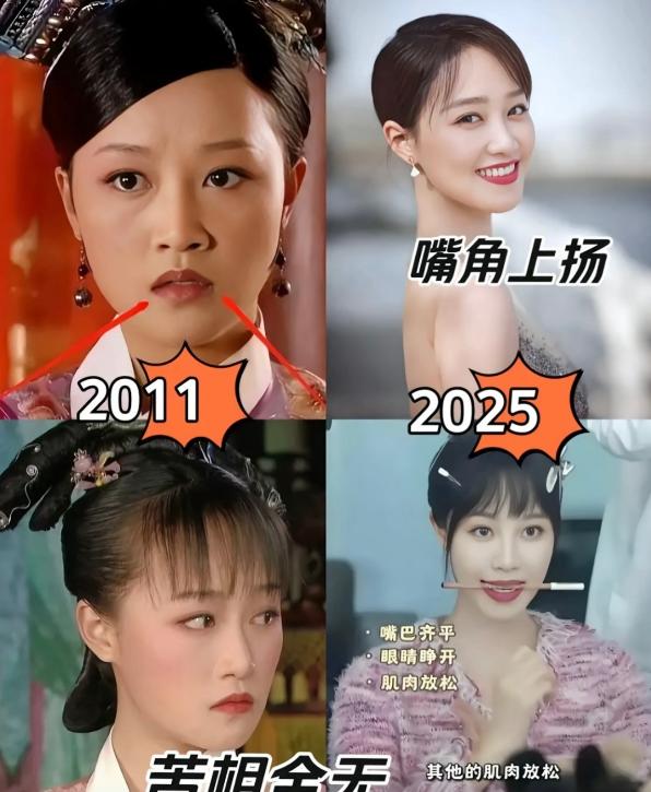 蓝盈莹的苦相脸竟然靠咬筷子6年，硬生生掰回来了。如今她直播教网友咬筷子改变面相：