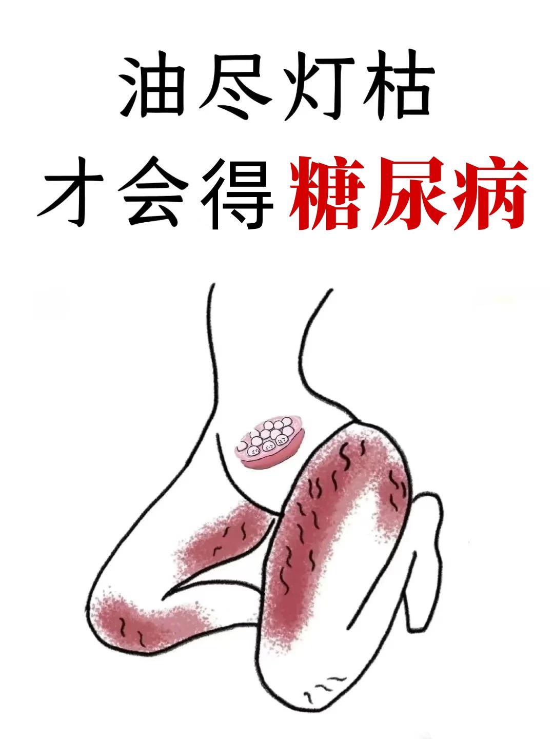糖尿病，就是这样来的！在很多人认知里，糖尿病不过是血糖高了，只要降糖就行。但