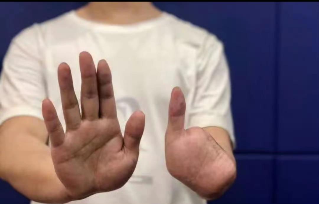 手指泡酒视频疯传，高薪梦变断指地狱，谁在暗处等你上钩？最近网上流传一个视频，