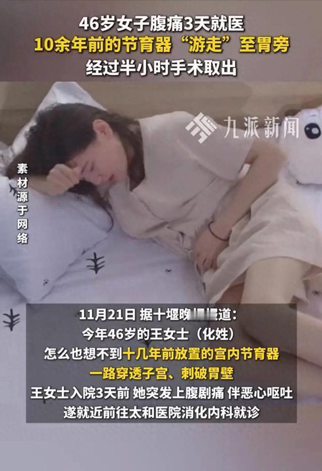 46岁王女士因腹痛就医，竟因十几年前放置的节育器穿破子宫、刺破胃壁！近年来，节