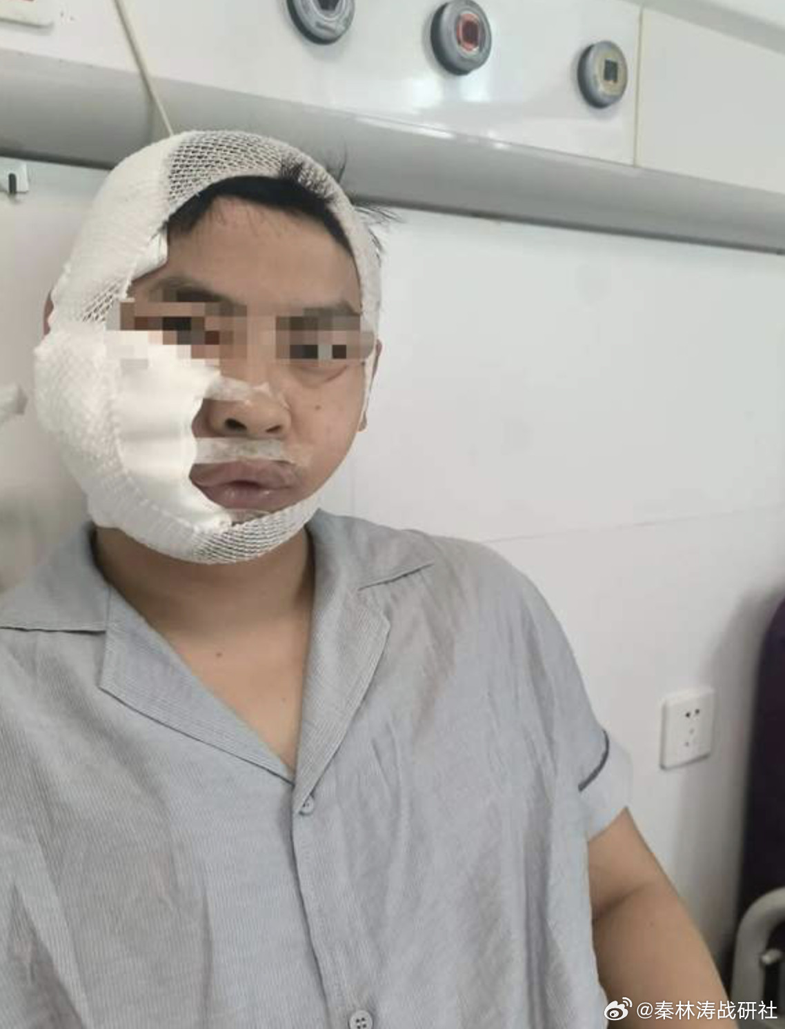 男子花480元潜水被鲨鱼咬9处这哪是潜水体验，简直是“鲨口逃生”真人秀！下水