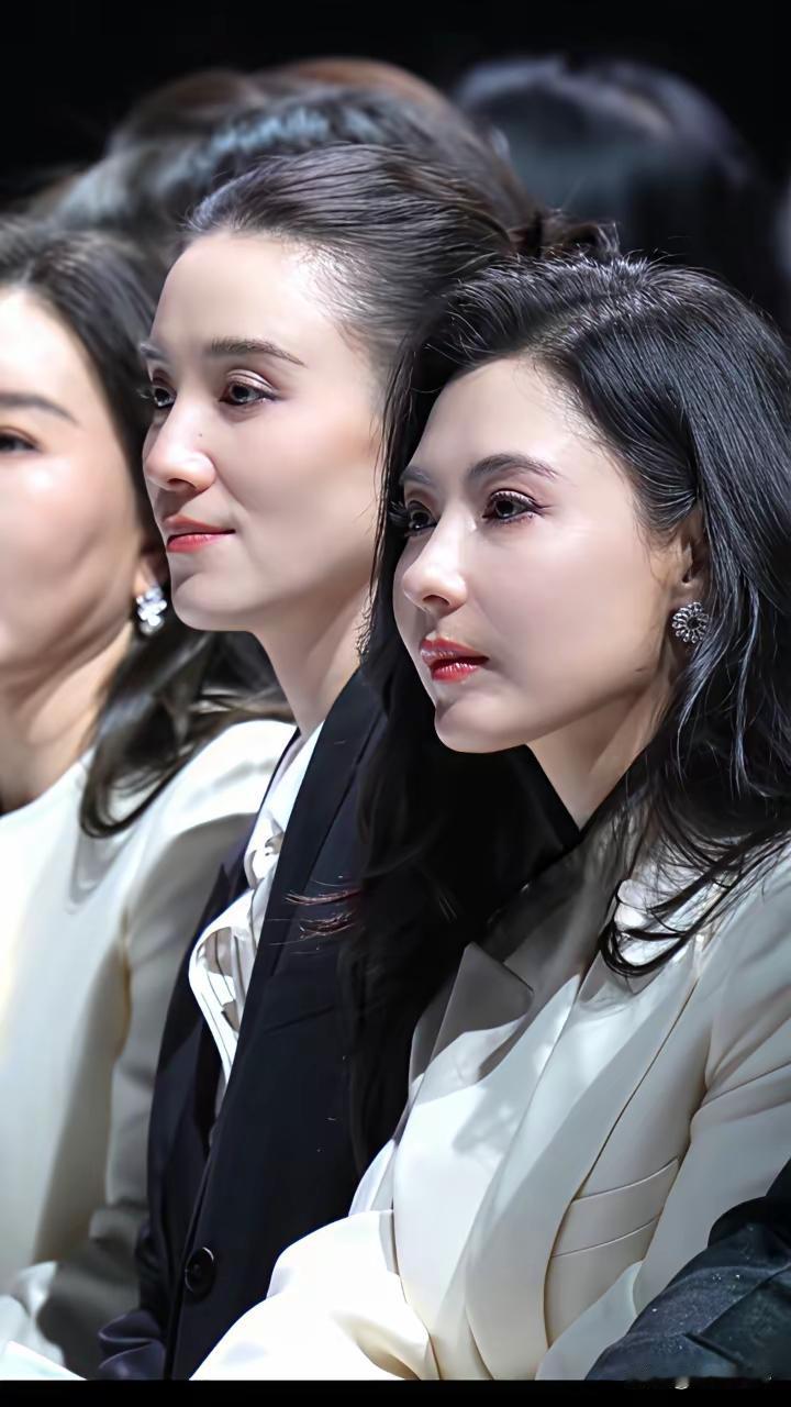 宋佳很美丽很好看，很有气质张柏芝脸有点肿应该是医美过后的后遗症