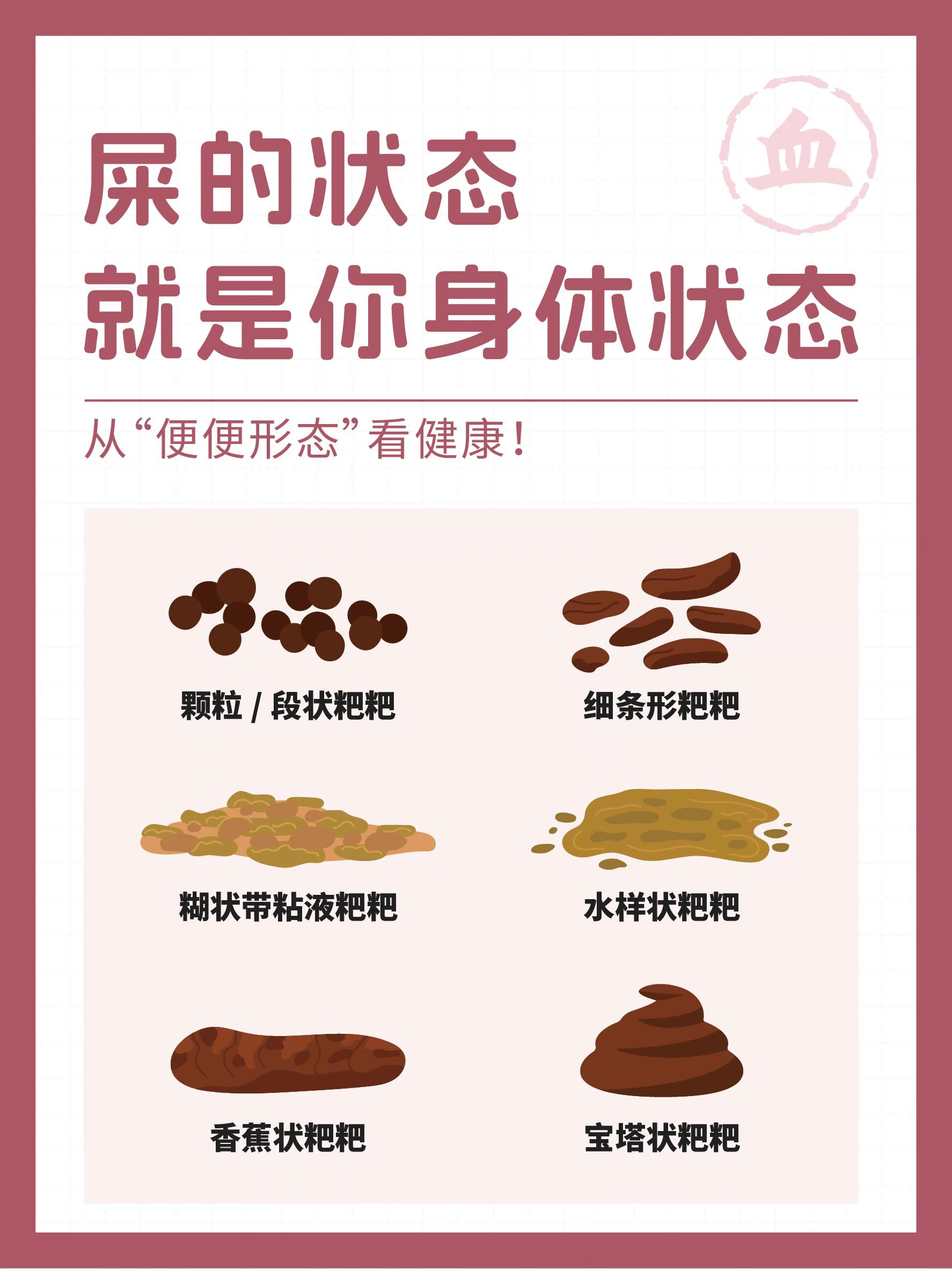 屎的状态，就是你身体的状态。