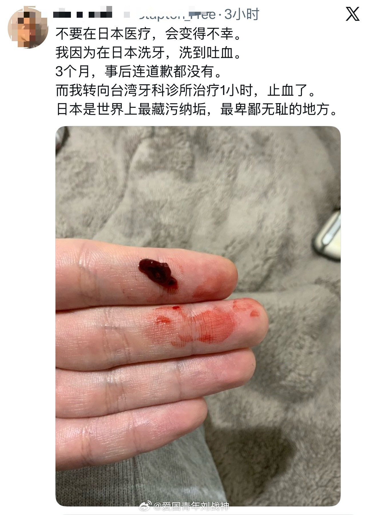 台湾网友吐槽日本医疗：日本是世界上最藏污纳垢，最卑鄙无耻的地方！海外新鲜事热点现