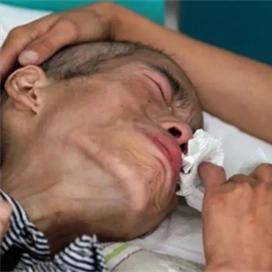 当亲人患绝症，是否继续治疗是一个艰难的抉择，需要综合多方面因素考量。从情感层