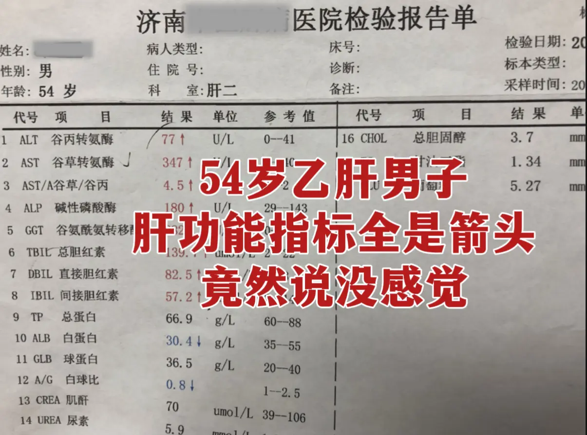 54岁乙肝20多年没放心上，最近一段时间家人发现他脸色蜡黄，一直催促他...