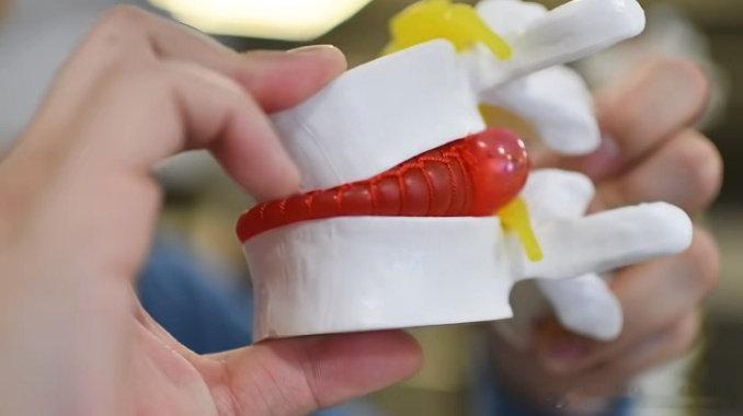 腰椎间盘突出【腰突康复】继续来聊聊腰突，从基本的概念➕康复黄金法则➕康复误区：