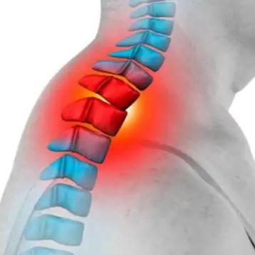 这位女士的情况反映了颈椎间盘突出症可能引发的严重神经压迫和突发性神经功能障碍的风