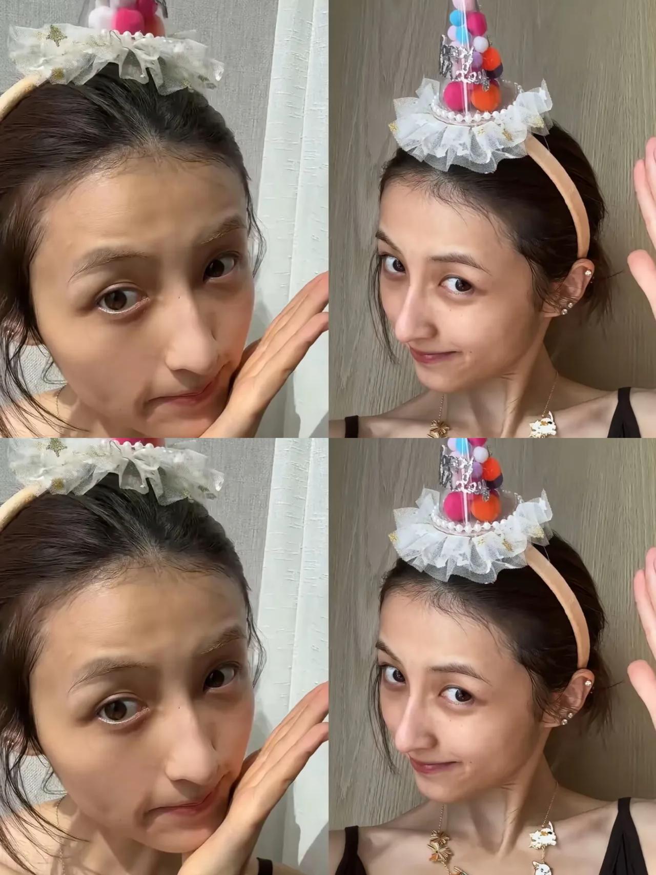 现在的张子枫，给所有爱美的女生提了个醒，你可以去拉皮，也可以去除皱，还可以打